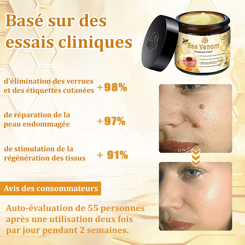 Crème au venin d’abeille (Bee Venom Treatment Cream)