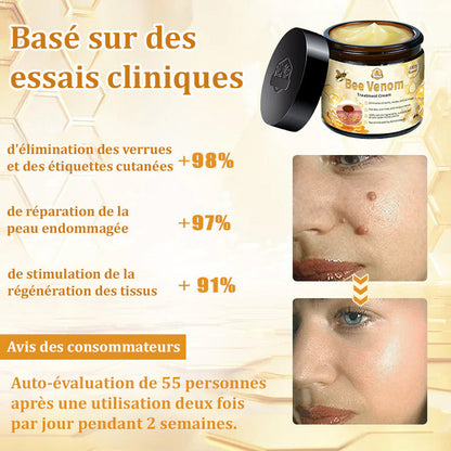 Crème au venin d’abeille (Bee Venom Treatment Cream)