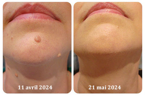 Crème au venin d’abeille (Bee Venom Treatment Cream)