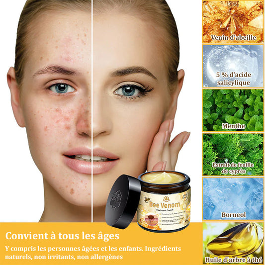 Crème au venin d’abeille (Bee Venom Treatment Cream)