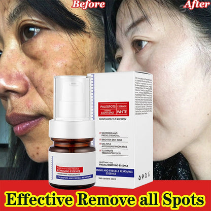 Sérum pour le visage blanchissant à la vitamine C, élimine les tâches brunes du mélasma et éclaircit la mélanine