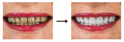 Dentifrice blanchissant à la Niacinamide Ultra Efficace