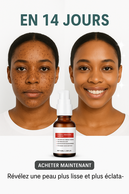 Sérum pour le visage blanchissant à la vitamine C, élimine les tâches brunes du mélasma et éclaircit la mélanine