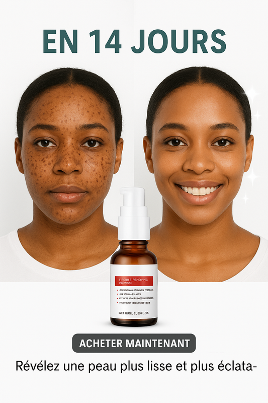 Sérum pour le visage blanchissant à la vitamine C, élimine les tâches brunes du mélasma et éclaircit la mélanine
